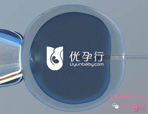 美國試管嬰兒