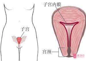 美國試管嬰兒